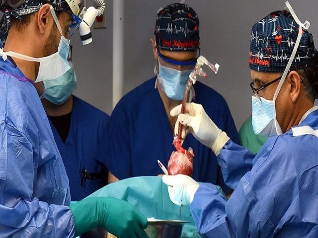 Segundo humano recebe transplante de coração de porco nos Estados Unidos
