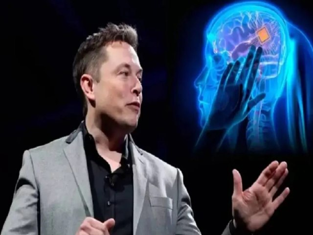 Humano recebe primeiro implante de chip cerebral de empresa de Elon Musk