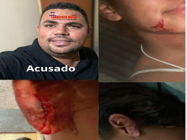 Mulher  brutalmente agredida em via pblica pelo ex-companheiro em Mirandiba.