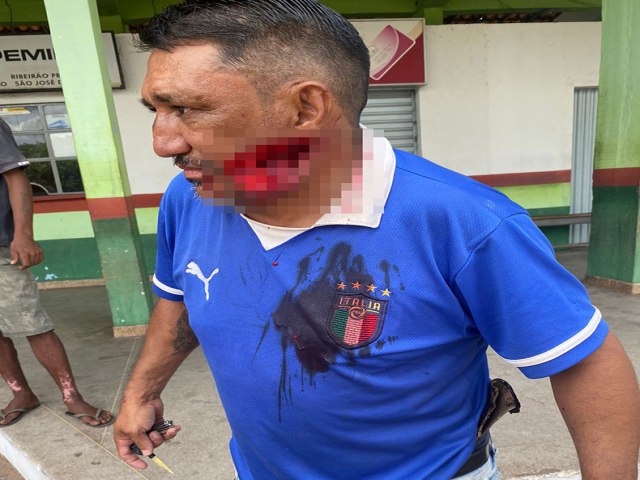 Homem que teve parte da face arrancada com faco morre em Hospital de Picos